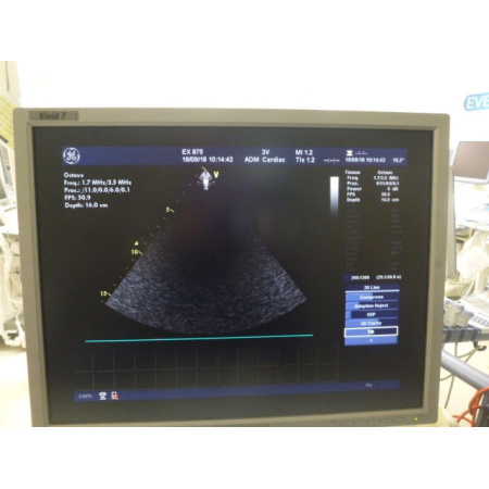 bfb778_00401bd126f44cae84c1848622dc6589mv2