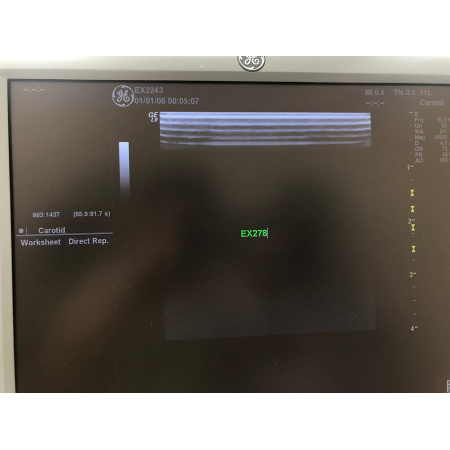 bfb778_ab43580a41cd4328b4b87032ba932f35mv2