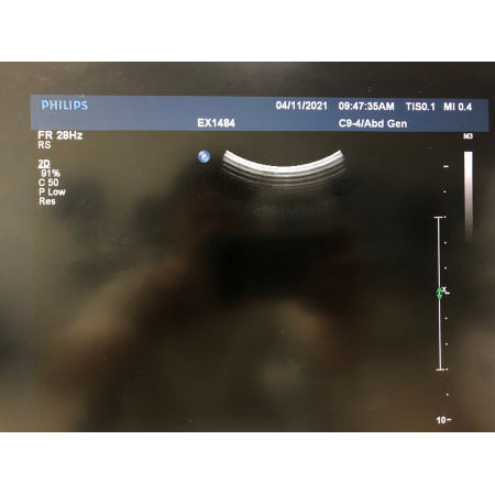 bfb778_aea57ff3b933458cac144d5a676b9d95mv2