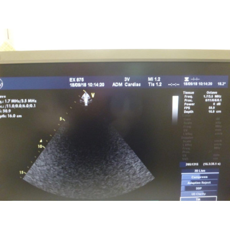 bfb778_cad0ee678eb3484fa973bc4ecab98e91mv2