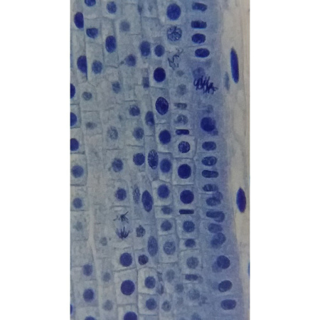 bresser-bino-40x-400x-professional-microscope_6